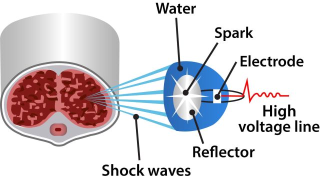 3 water spark wave tissue