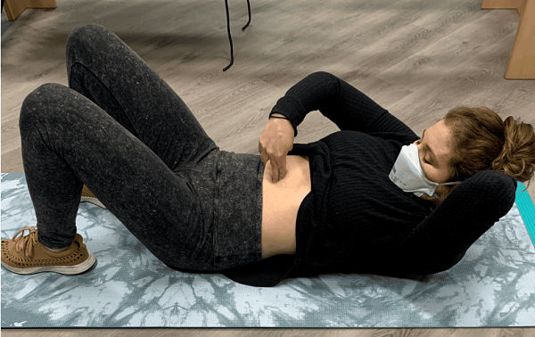 diastasis rectus abdominis example 1