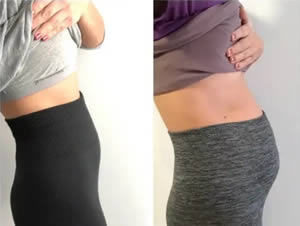 Photo courtesy of Alexandra Camara showing her belly before and after her endometriosis related bloating. Alexandra Camara/Personal Photo 