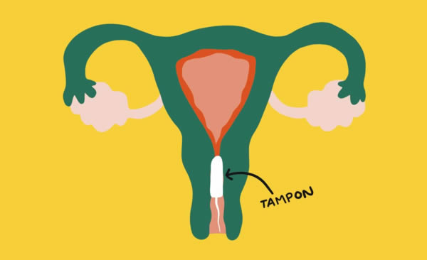 Hole Diagram How To Insert A Tampon Ilustración De Cómo Us