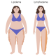 How to Help Lipedema and Lymphedema - Part 1