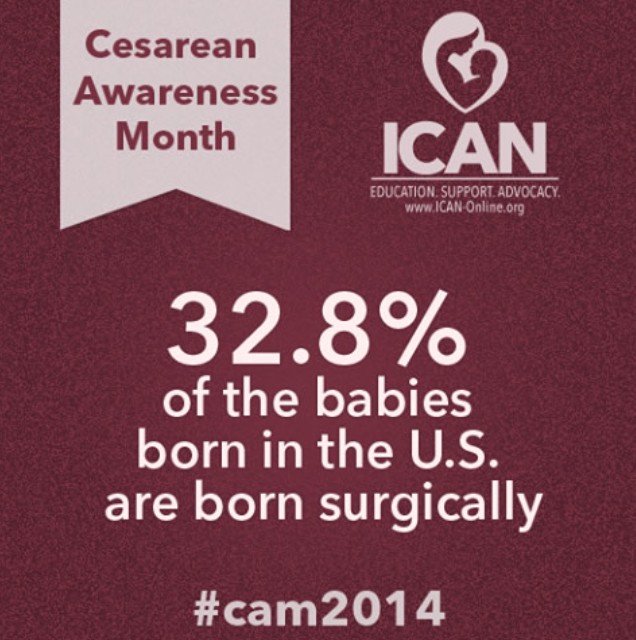 Cesarean Section Early Recovery Exercises