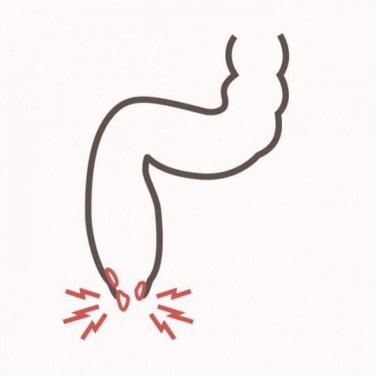What is the Difference Between Rectal Prolapse and Hemorrhoids?