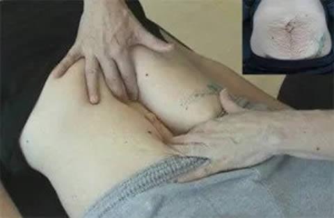 Mommy Tummy – Not Something You Have to Just Live With