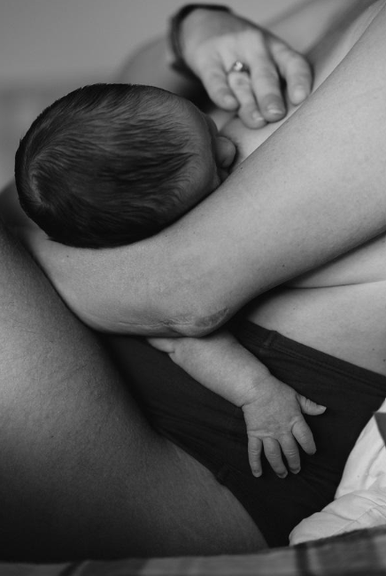 How Physical Therapy Can Help with Clogged Milk Ducts and Mastitis