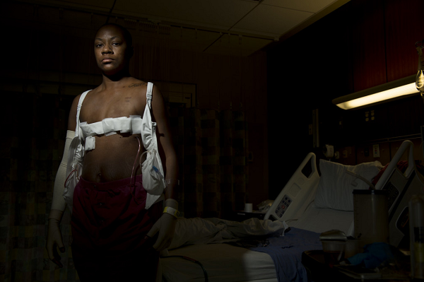 Breast Cancer Surgery and Physical Therapy | Postoperative Exercise