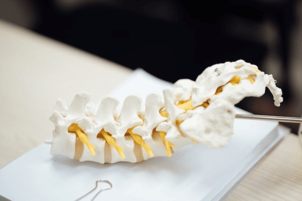 Tarlov Cyst: Physical Therapy and Treatment Options