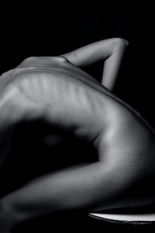 Scoliosis and Conservative Physical Therapy: Part 1 Scoliosis Awareness Month