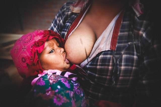 Therapeutic Breast Massage in Lactation (TBML)