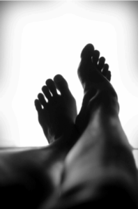 how to manage swelling during pregnancy - edema