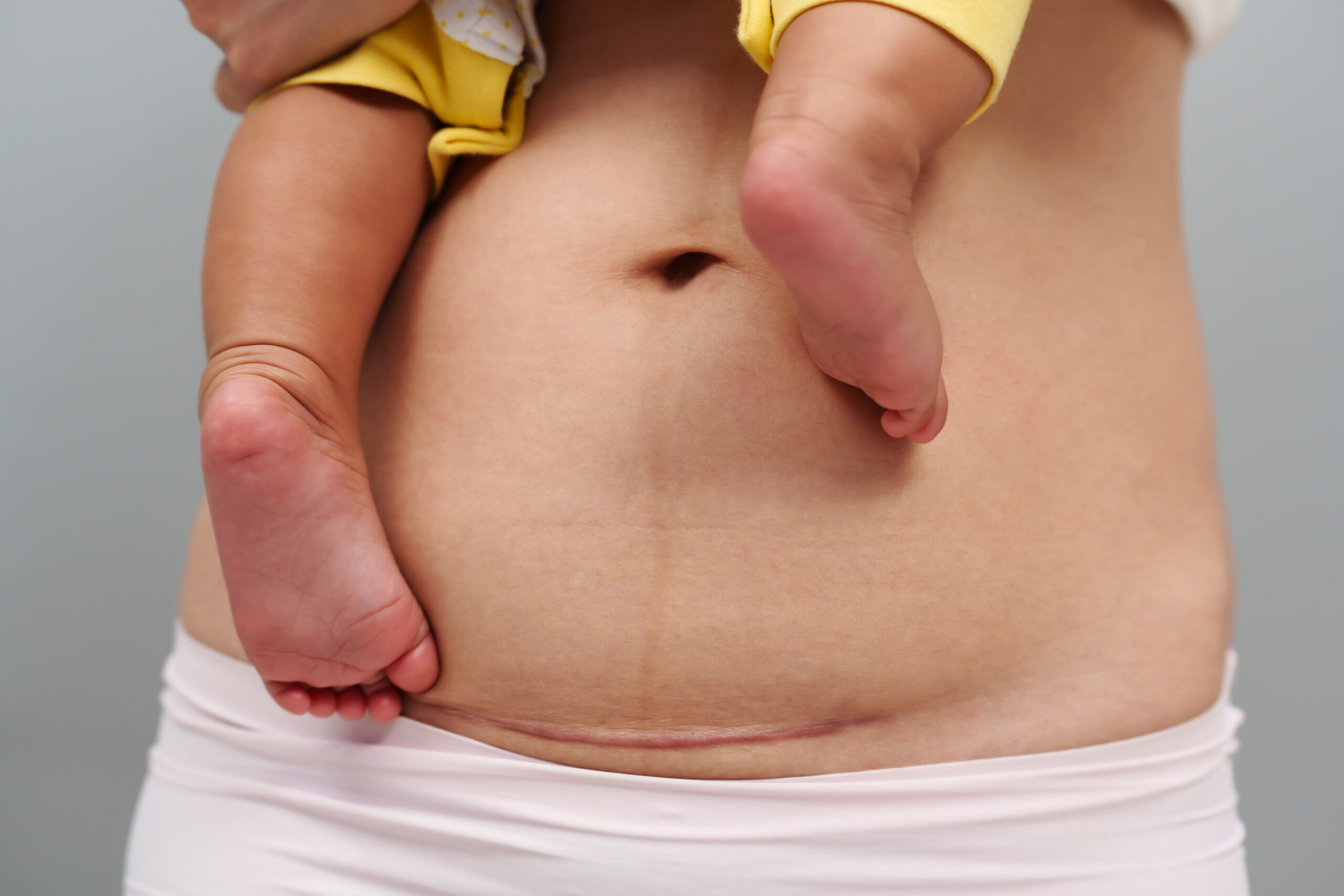 Treatment Options for Postpartum Pelvic Pain Therapy in Los Angeles, CA