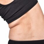 GLP-1 Medications and Bloating: Why You Feel Distended (and What Actually Helps)