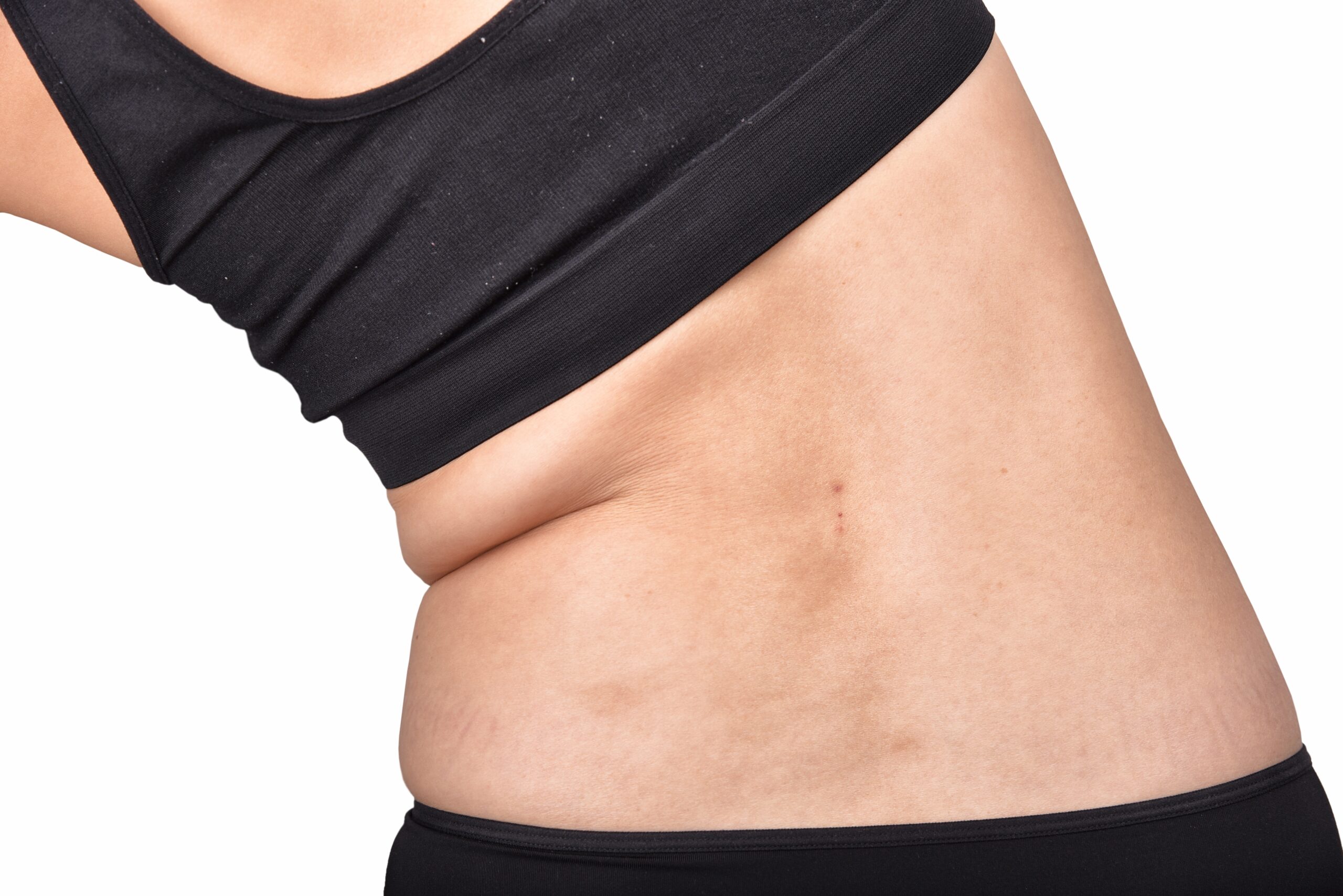 does glp 1 make you bloated GLP-1 Medications and Bloating: Why You Feel Distended